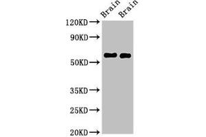 Western Blot Positive WB detected in: Mouse brain tissue, Rat brain tissue All lanes: GAS7 antibody at 2.