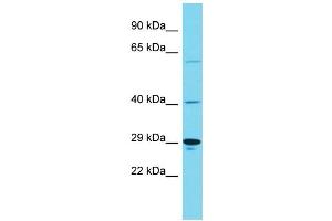 Host: Rabbit Target Name: KIAA1919 Sample Type: Hela Whole Cell lysates Antibody Dilution: 1. (KIAA1919 antibody  (Middle Region))