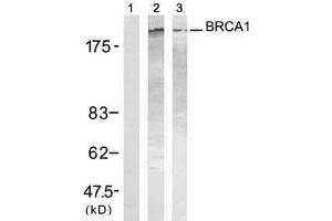 Western blot analysis of extracts from HT-29 and K562 cells treated with UV (20min), using BRCA1 (Ab-1423) antibody (E021234, Lane 1, 2 and 3) . (BRCA1 antibody)