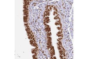 Immunohistochemical staining of human fallopian tube with HNRNPA1 polyclonal antibody  shows strong nuclear positivity at 1:200-1:500 dilution. (HNRNPA1 antibody)