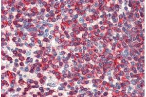 Human Spleen: Formalin-Fixed, Paraffin-Embedded (FFPE) (WDHD1 antibody  (C-Term))