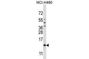 SMCP Antibody (C-term) western blot analysis in NCI-H460 cell line lysates (35µg/lane). (SMCP antibody  (C-Term))