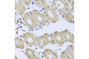 Immunohistochemistry of paraffin-embedded human stomach using SYT4 antibody (ABIN5975174) at dilution of 1/100 (40x lens).