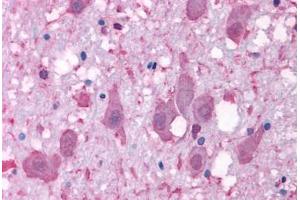 Anti-NPY2R antibody  ABIN1049123 IHC staining of human brain, neurons and glia.