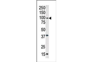 Image no. 1 for anti-C-Abl Oncogene 1, Non-Receptor tyrosine Kinase (ABL1) (pTyr245) antibody (ABIN358068)