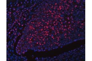 anti-Regulatory Factor X, 1 (Influences HLA Class II Expression) (RFX1) (AA 48-977) antibody