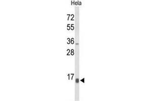 Western blot analysis of NPW Antibody (C-term) in Hela cell line lysates (35µg/lane).