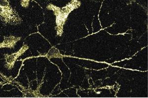 Immunofluorescence staining of rat neurons. (alpha Adaptin antibody  (AA 38-215))