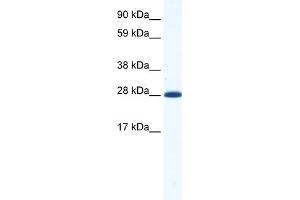 WB Suggested Anti-DLX4 Antibody Titration:  1. (DLX4 antibody  (N-Term))