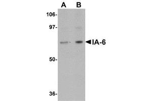 Western blot analysis of IA-6 in rat thymus tissue lysate with AP30397PU-N IA-6 antibody at (A) 1 and (B) 2 μg/ml. (INSM2 antibody  (C-Term))