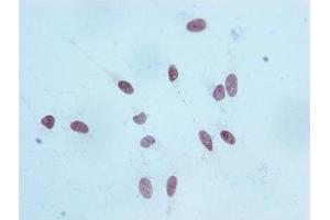 Immunocytochemistry (ICC) image for anti-Histone Cluster 1, H3a (HIST1H3A) (H3K18me) antibody (ABIN7127300)
