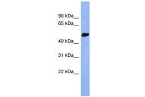 Image no. 1 for anti-serine/threonine Kinase 25 (STK25) (AA 274-323) antibody (ABIN6746292)