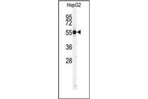 Image no. 3 for anti-Cathepsin H (CTSH) (AA 32-62), (N-Term) antibody (ABIN452890) (Cathepsin H antibody  (N-Term))