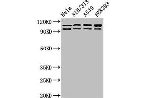 Western Blot Positive WB detected in: Hela whole cell lysate, NIH/3T3 whole cell lysate, A549 whole cell lysate, HEK293 whole cell lysate All lanes: MSH2 antibody at 2 μg/mL Secondary Goat polyclonal to rabbit IgG at 1/50000 dilution Predicted band size: 105, 98 kDa Observed band size: 105, 98 kDa (MSH2 antibody  (AA 2-254))