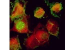 Immunofluorescence (IF) image for anti-Herpes Simplex Virus Type 1 ICP0 (HSV1 ICP0) antibody (ABIN265559) (HSV1 ICP0 antibody)