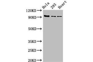 Western Blot Positive WB detected in: Hela whole cell lysate, 293 whole cell lysate, Rat heart tissue All lanes: MCM4 antibody at 2. (MCM4 antibody  (AA 2-141))