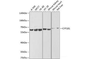 Western blot analysis of extracts of various cell lines using CYP1B1 Polyclonal Antibody at dilution of 1:1000. (CYP1B1 antibody)
