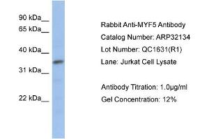 Western Blotting (WB) image for anti-Myogenic Factor 5 (MYF5) (N-Term) antibody (ABIN182493)