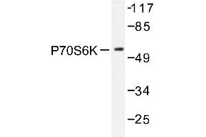 Image no. 1 for anti-Ribosomal Protein S6 Kinase, 70kDa, Polypeptide 1 (RPS6KB1) antibody (ABIN272051) (RPS6KB1 antibody)