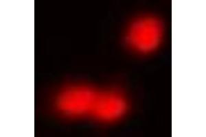 Immunofluorescent analysis of IRF8 staining in A549 cells. (IRF8 antibody)