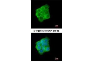ICC/IF Image Immunofluorescence analysis of paraformaldehyde-fixed A431, using Cytokeratin 13, antibody at 1:200 dilution. (Cytokeratin 13 antibody)