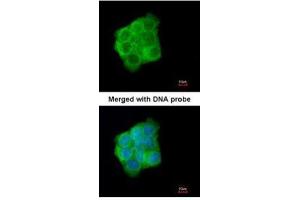 ICC/IF Image Immunofluorescence analysis of paraformaldehyde-fixed A431, using Cytokeratin 13, antibody at 1:200 dilution.