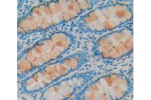 Used in DAB staining on fromalin fixed paraffin- embedded Kidney tissue (IRS2 antibody  (AA 985-1255))