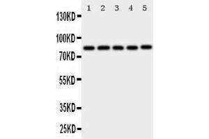 Western Blotting (WB) image for anti-X-Ray Repair Complementing Defective Repair in Chinese Hamster Cells 5 (Double-Strand-Break Rejoining) (XRCC5) (AA 648-662), (C-Term) antibody (ABIN3044235) (XRCC5 antibody  (C-Term))