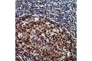 Immunohistochemical analysis of RCC1 staining in human tonsil formalin fixed paraffin embedded tissue section. (RCC1 antibody)