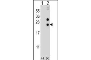 Western blot analysis of CSN1S1 (arrow) using rabbit polyclonal CSN1S1 Antibody (Center) (ABIN656838 and ABIN2846046).