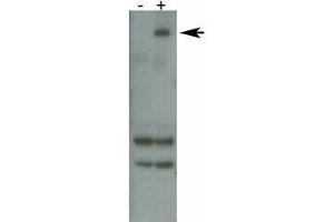 PARK8 / LRRK2 antibody detects over-expressed human LRRK2 protein. (LRRK2 antibody  (AA 878-909))