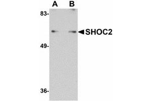 Image no. 1 for anti-Leucine-rich repeat protein SHOC-2 (SHOC2) (N-Term) antibody (ABIN478033) (SHoc2/Sur8 antibody  (N-Term))