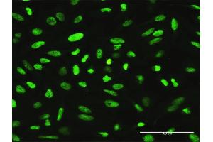 Immunofluorescence of purified MaxPab antibody to XRCC1 on HeLa cell. (XRCC1 antibody  (AA 1-633))