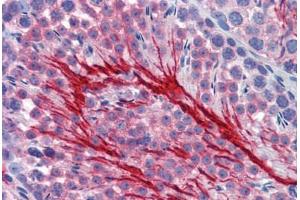 Mouse Testis (formalin-fixed, paraffin-embedded) stained with BSG antibody ABIN462349 followed by biotinylated secondary antibody, alkaline phosphatase-streptavidin and chromogen. (CD147 antibody)