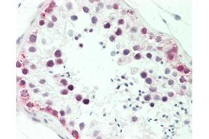 Anti-MTA1 antibody IHC staining of human testis. (MTA1 antibody  (AA 400-450))