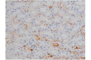 ABIN6255132 and ABIN6267338 at 1/200 staining Rat kidney tissue sections by IHC-P.