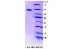 SDS-PAGE (SDS) image for Chromosome 15 Open Reading Frame 48 (C15ORF48) (AA 1-83) protein (His tag,GST tag) (ABIN2123404)