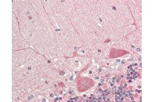 Immunohistochemistry (Paraffin-embedded Sections) (IHC (p)) image for anti-Dynein, Light Chain, LC8-Type 1 (DYNLL1) antibody (Biotin) (ABIN1955746)