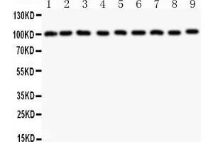 Anti-CBL Picoband antibody, All lanes: Anti-CBL at 0. (CBL antibody  (AA 556-906))