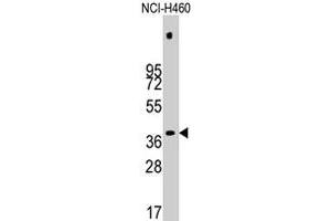 Western blot analysis of PDHX polyclonal antibody  in NCI-H460 cell line lysates (35 ug/lane).