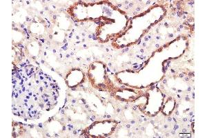 Paraformaldehyde-fixed, paraffin embedded rat kidney, Antigen retrieval by boiling in sodium citrate buffer (pH6. (SLC6A3 antibody  (AA 251-350))