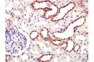 SLC6A3 antibody  (AA 251-350)