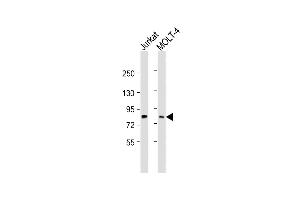 All lanes : Anti-LCP2 Antibody (Center) at 1:2000 dilution Lane 1: Jurkat whole cell lysate Lane 2: MOLT-4 whole cell lysate Lysates/proteins at 20 μg per lane. (LCP2 antibody  (AA 303-337))