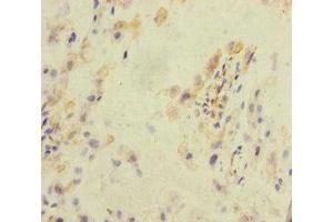 Immunohistochemistry of paraffin-embedded human placenta tissue using ABIN7157289 at dilution of 1:100 (KLHL26 antibody  (AA 366-615))