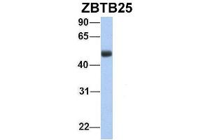 Host:  Rabbit  Target Name:  ZBTB25  Sample Type:  Human Fetal Lung  Antibody Dilution:  1. (ZBTB25 antibody  (Middle Region))