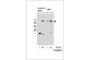 Western blot analysis of extracts from NIH-3T3 cells,untreated or treated with PDGF,using Phospho-Akt(Ser473)(left) or Akt Antibody (right). (AKT1 antibody  (pSer473))