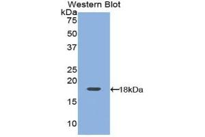 Western blot analysis of the recombinant protein. (Leptin antibody  (AA 15-141))