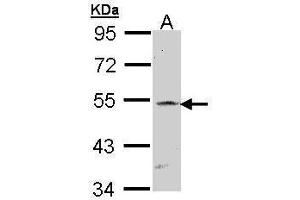 WB Image Sample (30 ug of whole cell lysate) A: Raji 7. (RBPJ antibody)