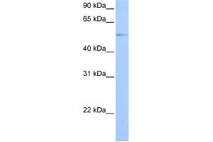 WB Suggested Anti-GRK4 Antibody Titration: 0. (GRK4 antibody  (Middle Region))
