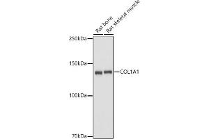 Western blot analysis of extracts of various cell lines, using Collagen I/COL1 antibody (6891) at 1:2680 dilution.